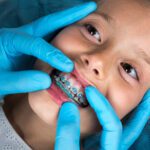 Are you wondering whether your child needs braces on their teeth? Read our guide about braces for kids plus the signs that indicate your child may need braces.