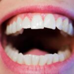 Misalignment of teeth is a common problem and your orthodontist can decide the best treatment for your teeth. Learn about treatments and more.