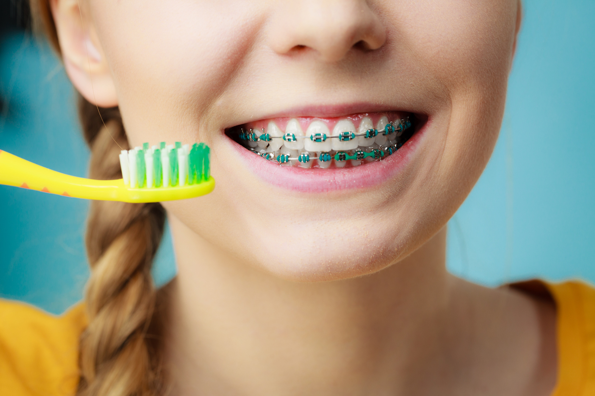 How much are braces for adults and children, and how can you manage the costs? Read this guide to learn about average prices and how to afford them.