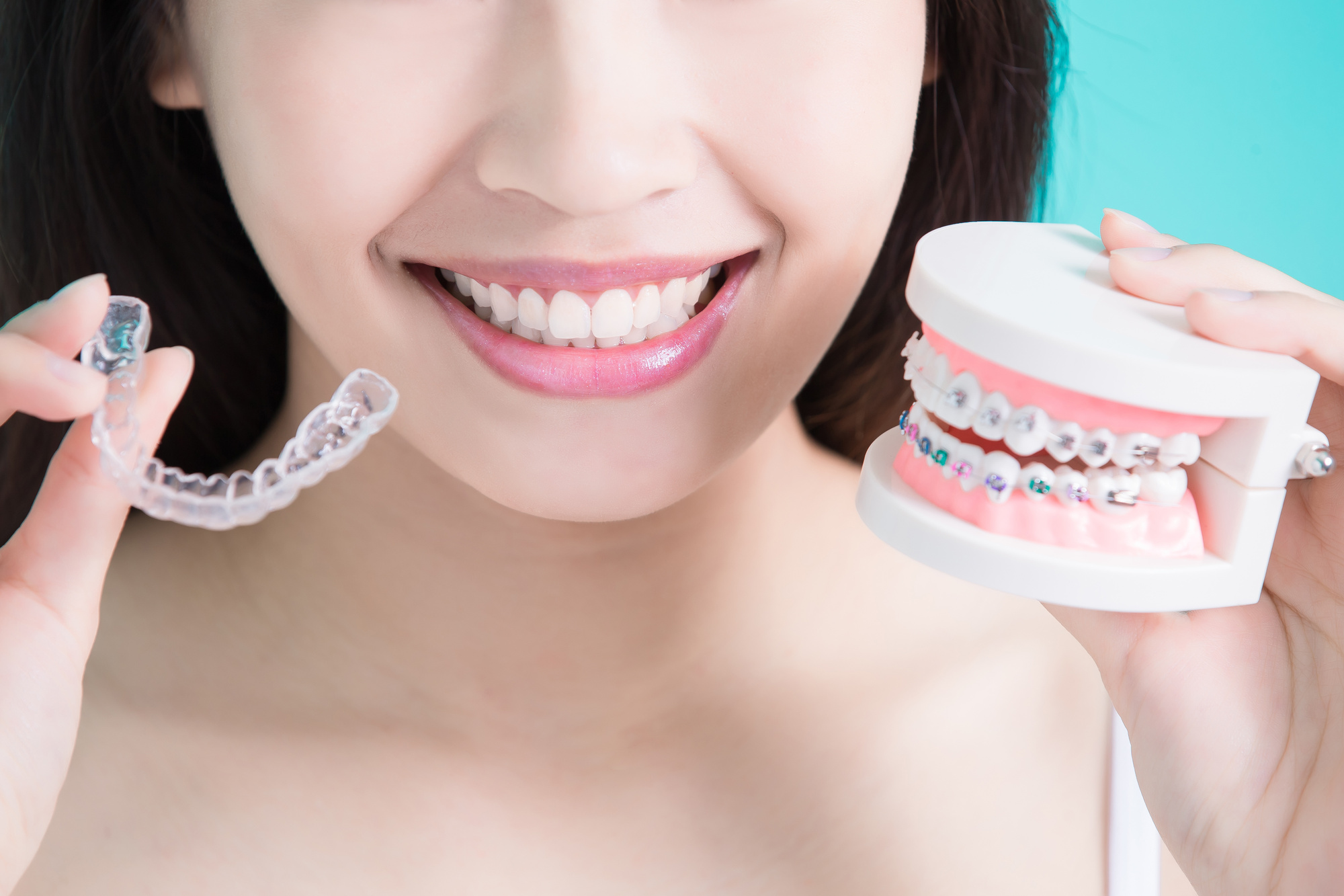 Are you wondering if Invisalign treatment is right for you? Click here for five important factors to consider before getting Invisalign.