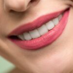 How to Achieve a Perfect Smile